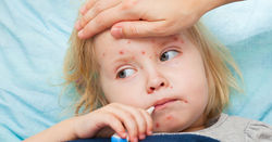In Italy, there was a measles outbreak